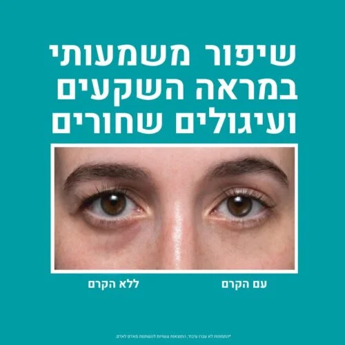 Peptide Skinjection Fill + Fix Under-Eye Cream – אזור העיניים עם הקרם ובלי הקרם, פיטר תומס רות