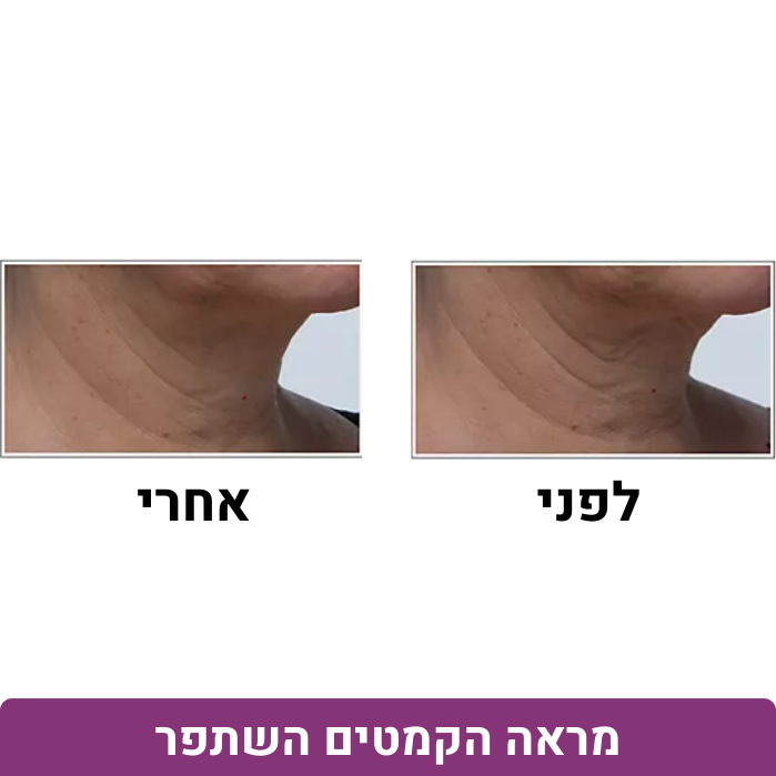 תמונות מוצר פיטר (1080 x 1080 px) (42)