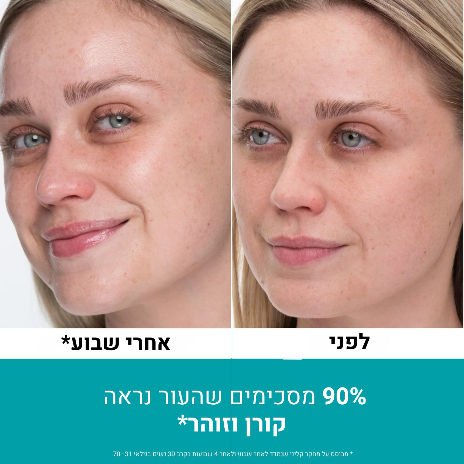 תמונות מוצר פיטר (1080 x 1350 px) (11)